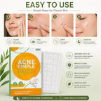 Acne Clearing Pimple Patches - Hydrocolloid Spot Patches (Pack of 2, 144 Patches)