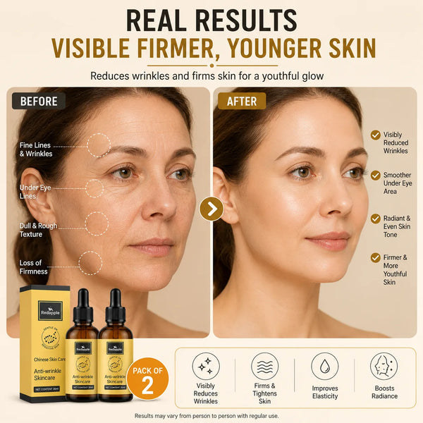 Anti-Wrinkle Serum & Anti-Aging Face Serum (Pack of 2) – Firming and Plumping Skin Treatment (30ml Each)