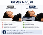 Cervical Pillow for Neck Pain Relief – Orthopedic Neck Support Pillow for Sleeping | Memory Foam Shoulder Pain Relief Pillow | Cervical Spine Support