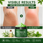 Cracked Heel Cream (Buy 1 Get 1 FREE) – Soothing Aloe Vera & Tea Tree Foot Crack Cream & Moisturizer