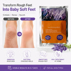 Foot Peel Mask for Dead Skin Removal (Pack of 2) – Exfoliating Foot Mask & Sock Pedicure Sheet