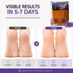 Foot Peel Mask for Dead Skin Removal (Pack of 2) – Exfoliating Foot Mask & Sock Pedicure Sheet