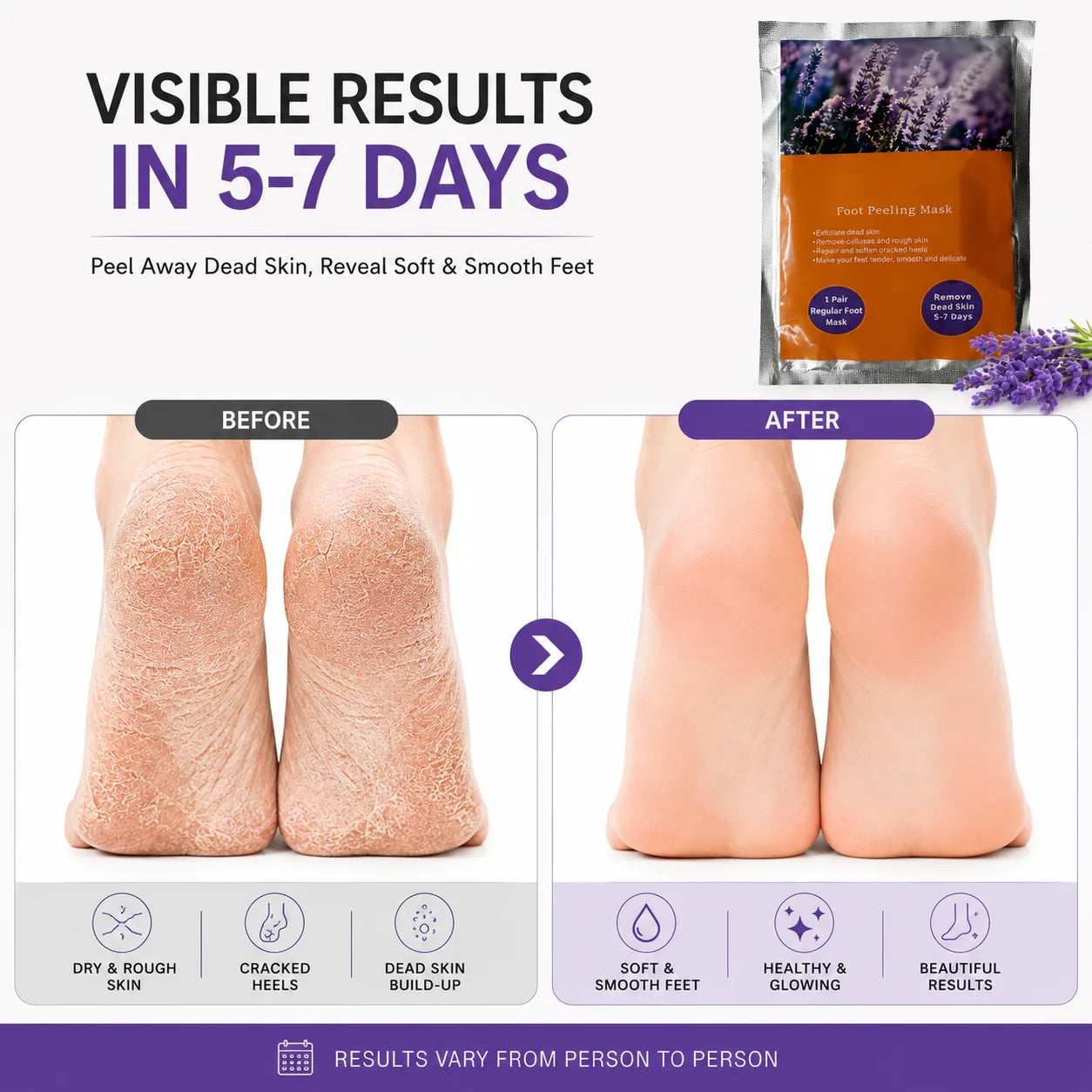 Foot Peel Mask for Dead Skin Removal (Pack of 2) – Exfoliating Foot Mask & Sock Pedicure Sheet