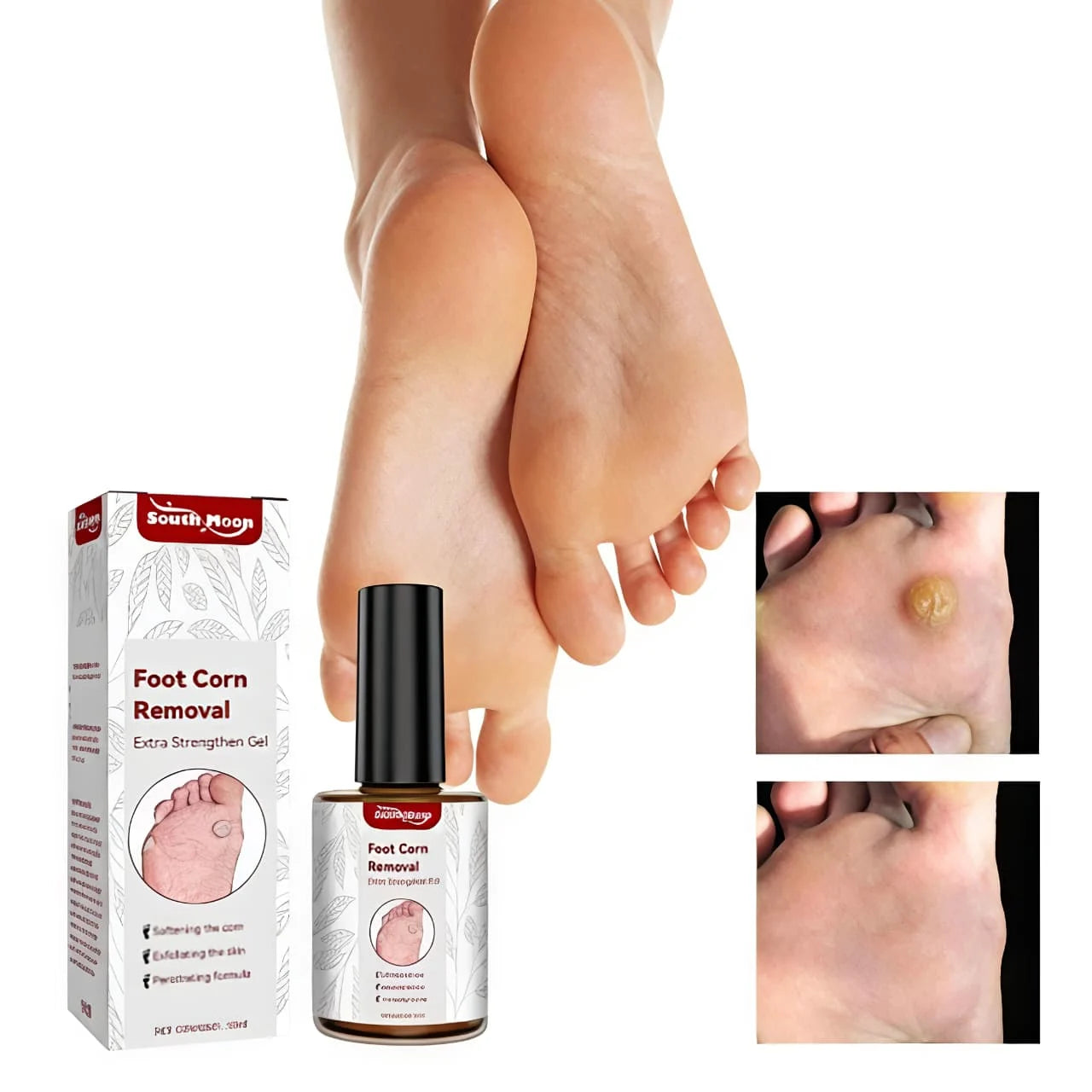 Foot Corn & Callus Removal Serum (30ml) – Fast-Acting Liquid Treatment for Cracked Heels & Permanent Pain Relief