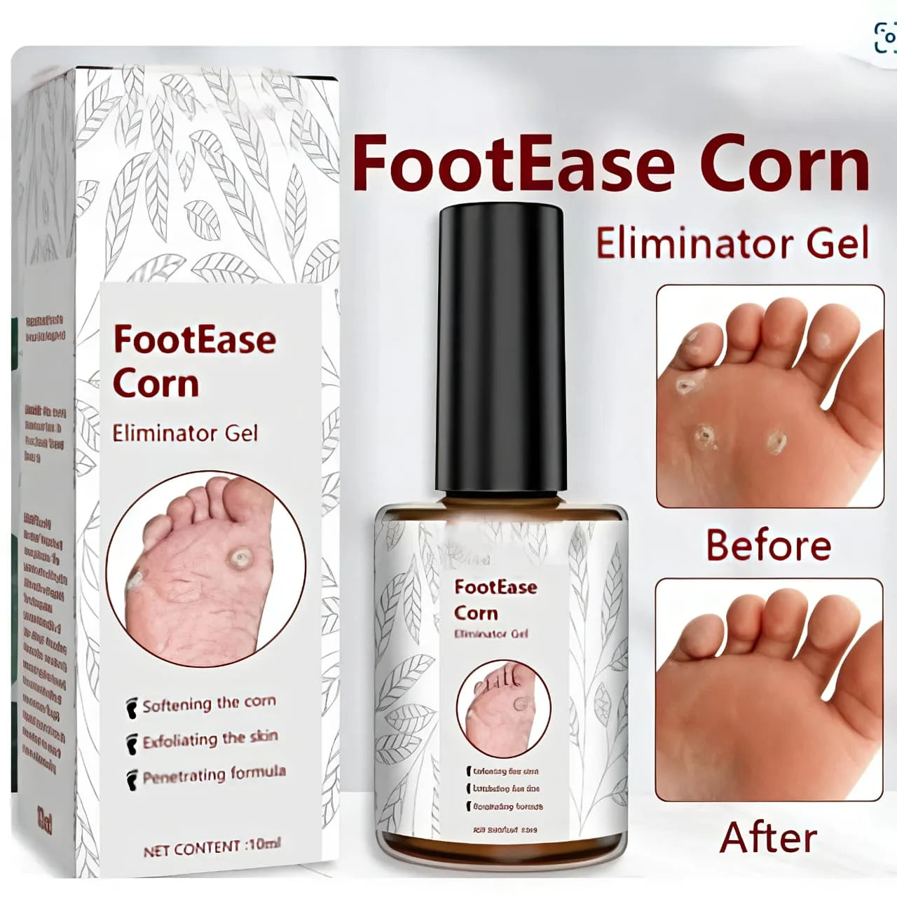 Foot Corn & Callus Removal Serum (30ml) – Fast-Acting Liquid Treatment for Cracked Heels & Permanent Pain Relief