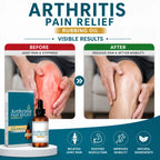 Pain Relief Gel Frankincense Herbal Massage Formula (Pack of 2) – Fast Relief Gel for Muscle & Joint Comfort
