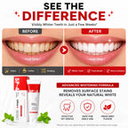 (Pack of 2) Tooth Whitening Toothpaste for Sensitive Teeth – Premium Teeth Bleaching White Paste & Stain Remover