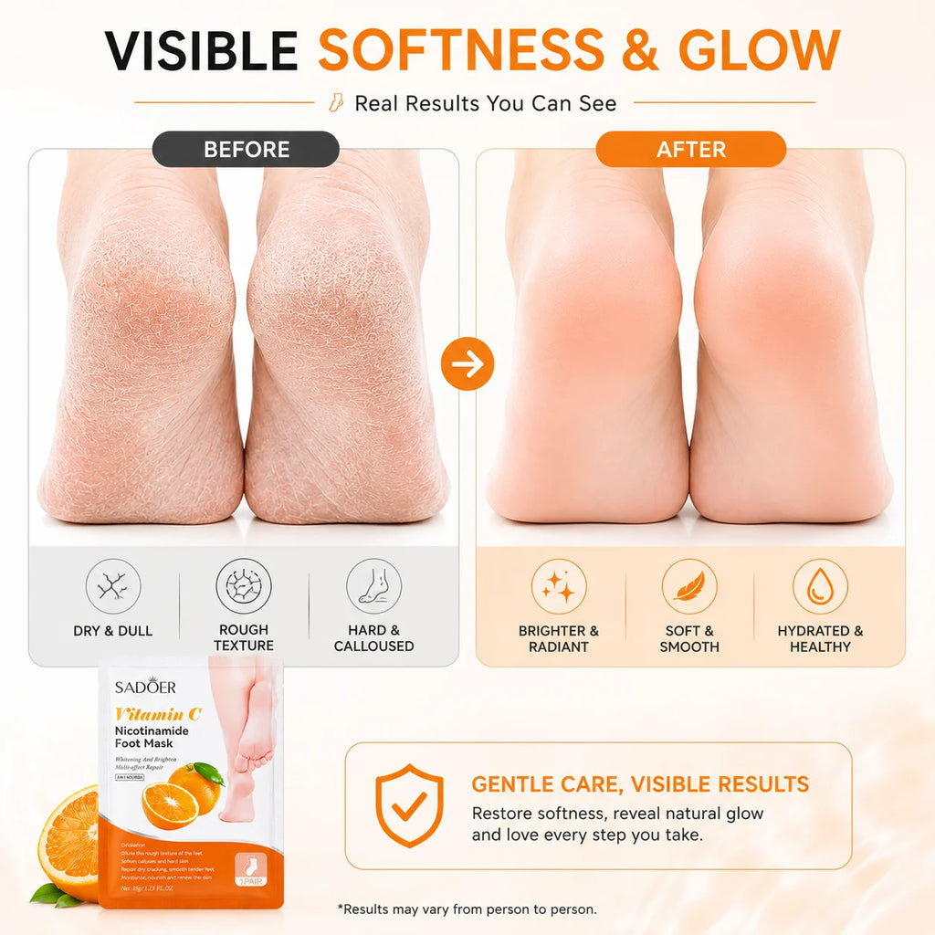 Vitamin C Foot Peel Mask (Pack of 1) – Brightening Exfoliating Foot Mask & Pedicure Socks