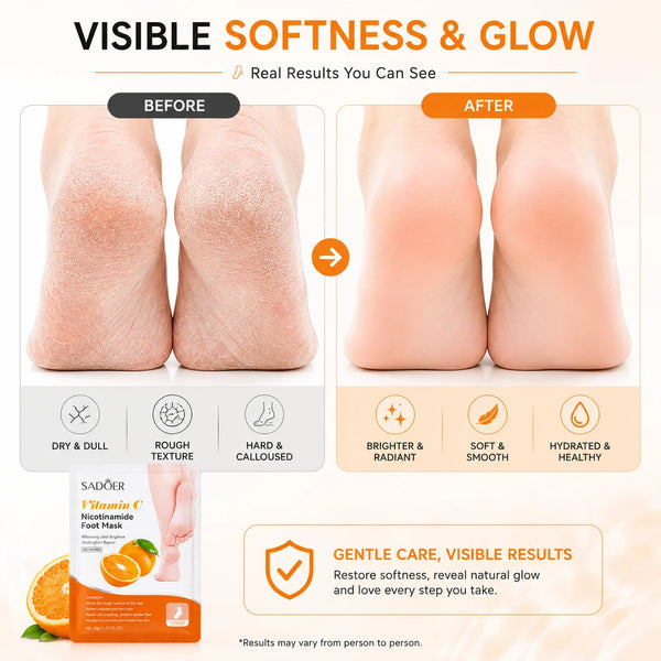 Vitamin C Foot Peel Mask (Pack of 1) – Brightening Exfoliating Foot Mask & Pedicure Socks