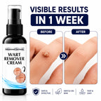 (Pack of 2) Wart Removal Cream Skin Care Tag Ointment – Best Wart Cream for Face, Body & Clear Skin Care