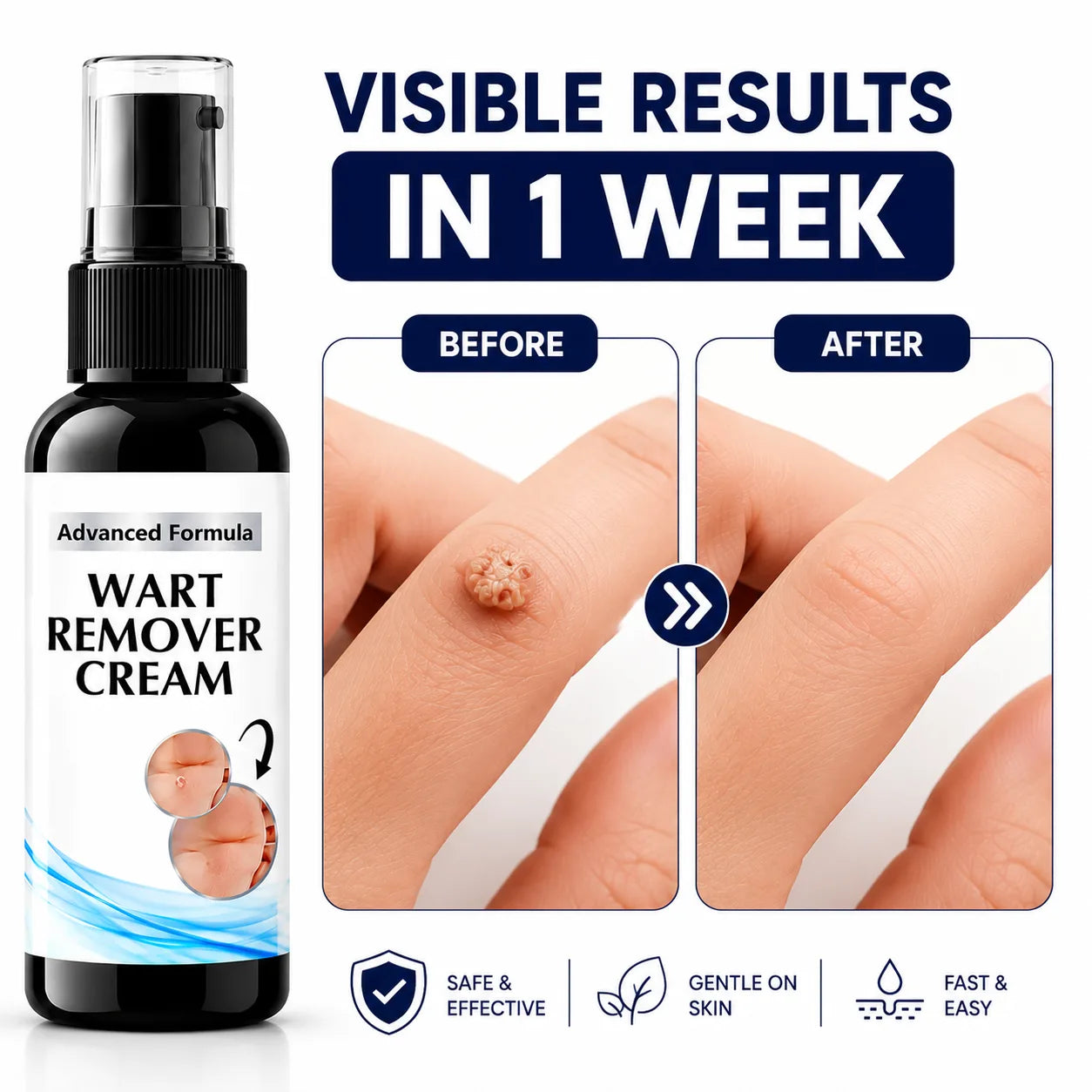 (Pack of 2) Wart Removal Cream Skin Care Tag Ointment – Best Wart Cream for Face, Body & Clear Skin Care