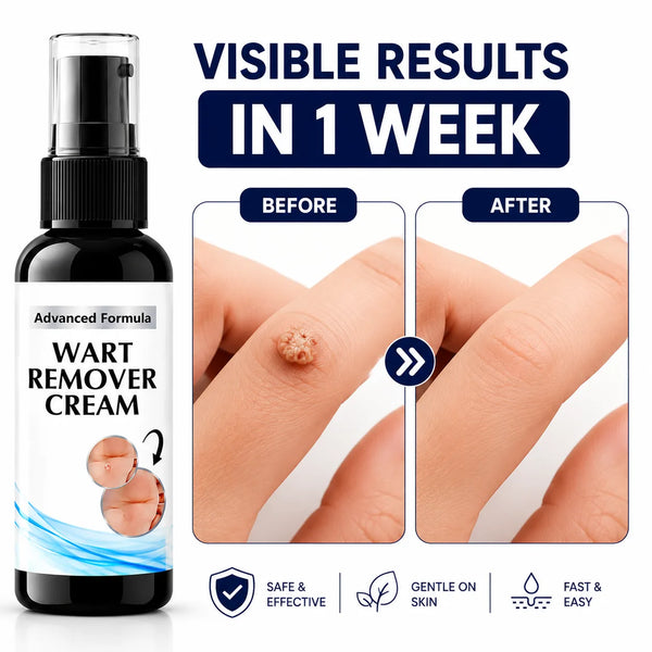 (Pack of 2) Wart Removal Cream Skin Care Tag Ointment – Best Wart Cream for Face, Body & Clear Skin Care