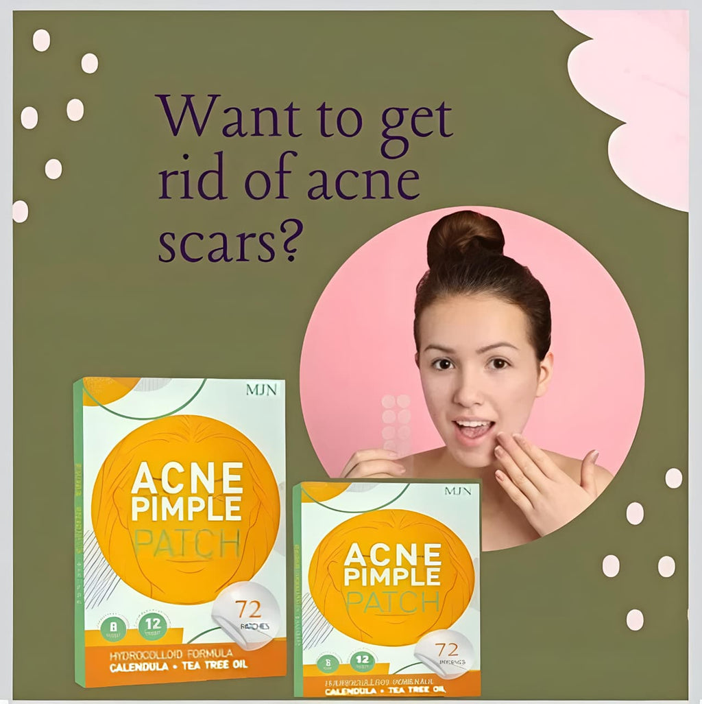 Acne Clearing Pimple Patches - Hydrocolloid Spot Patches (Pack of 2, 144 Patches)