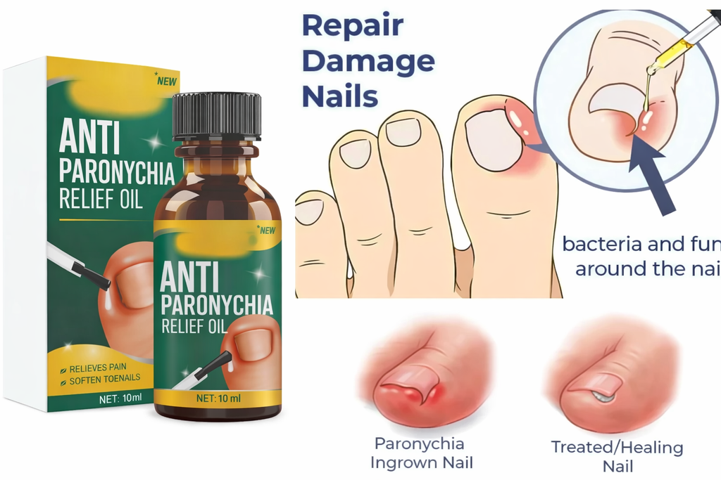 (Pack of 2) Anti Paronychia Relief Oil Toenail Repair Oil – Natural Herbal Treatment for Ingrown Toenails & Cuticle Care