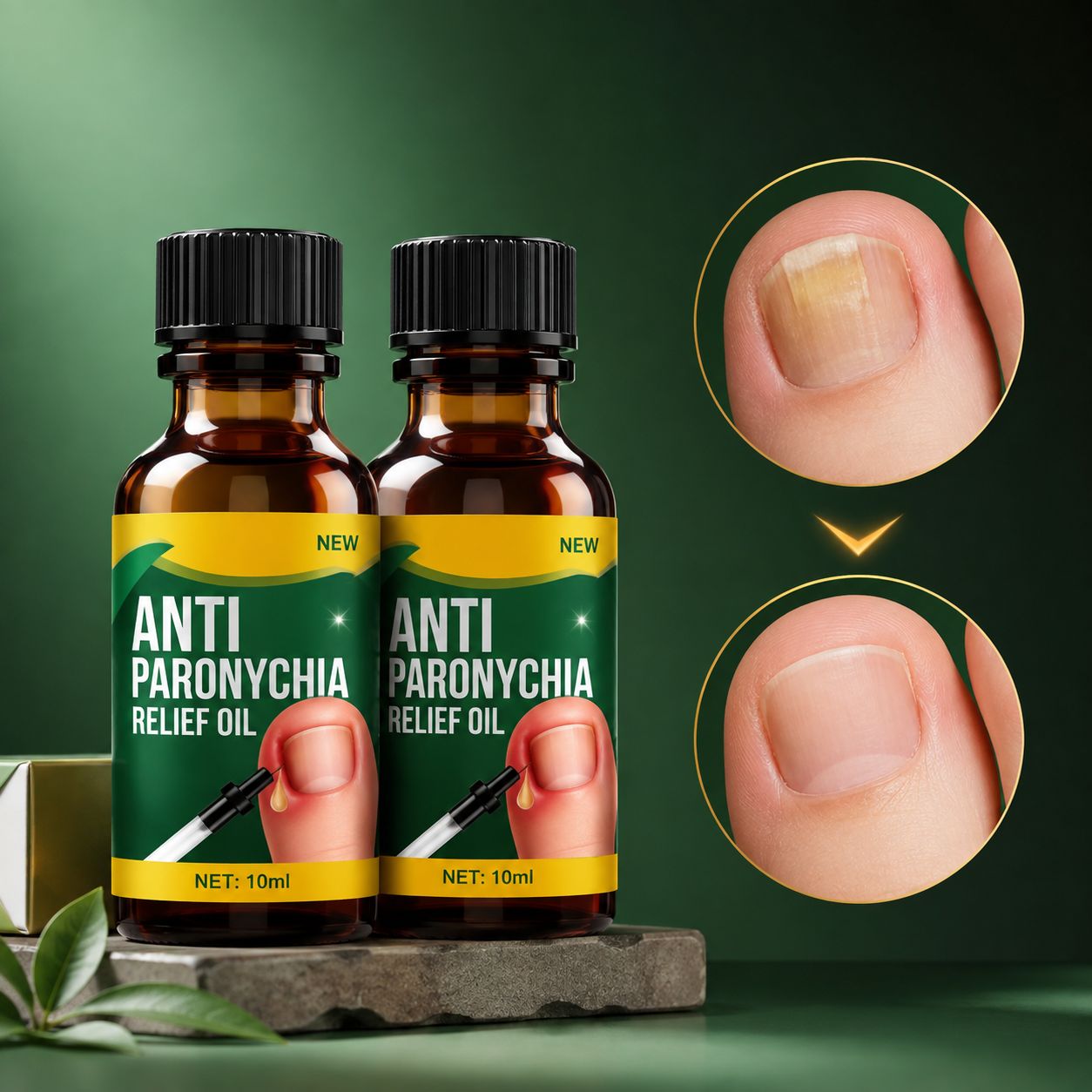 (Pack of 2) Anti Paronychia Relief Oil Toenail Repair Oil – Natural Herbal Treatment for Ingrown Toenails & Cuticle Care