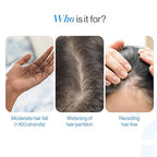 (Pack of 2) Hair Growth Serum Roll-On Hairline Growth Serum – Triple Roller Scalp Applicator for Hair Regrowth, Follicle Nourishment & Density