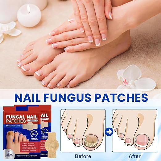 (21 Pcs) Fungi Nail Patches White Patches on Nails Repair Patches – Herbal Care for Discolored Toenails & Fingernails