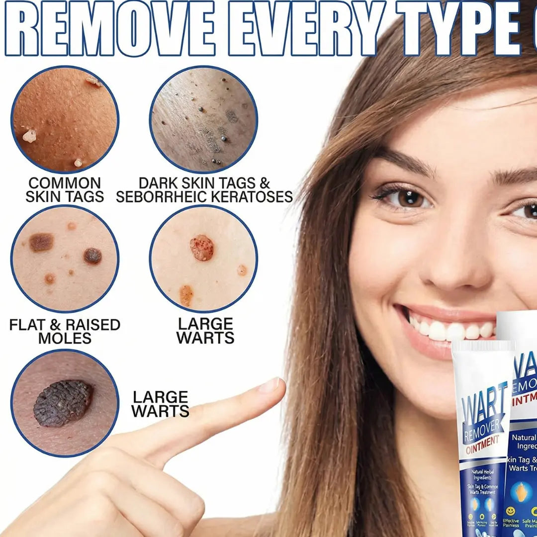Wart Removal Cream & Skin Tag Remover (Pack of 2) – Painless Corn & Face Tag Treatment Ointment